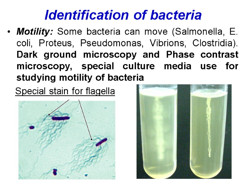 Identification of bacteria  Motility: Some bacteria can move (Salmonella, E. coli, Proteus, Pseudomonas,